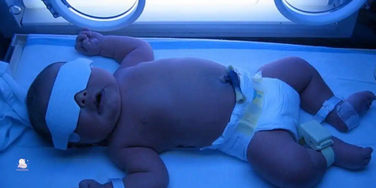 خطر ابتلا به کرنیکتروس بر اثر بی توجهی به زردی نوزاد
