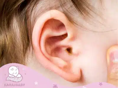 علت ترشح زرد رنگ عفونت گوش نوزادان