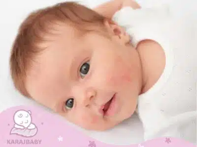خشکی پوست نوزاد